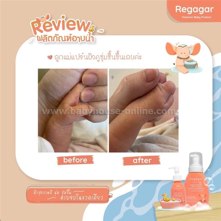 โฟมอาบน้ำเด็ก ผิวแพ้ง่าย ผิวแห้ง ลดแบคทีเรีย ลดอาการผิวหนังอักเสบ สูตรแพทย์ Soft Foam Wash And Shampoo l Regagar